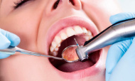 Стоматолог ответил, почему лечить зубы так дорого