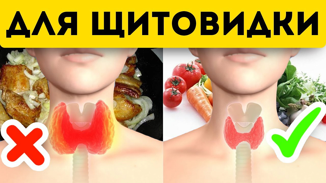 ПРОДУКТЫ, ВРЕДНЫЕ ДЛЯ ЩИТОВИДНОЙ ЖЕЛЕЗЫ: ЧТО НЕЛЬЗЯ ЕСТЬ